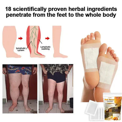 Bee Venom Foot Patches (Pack of 40) BUY 1 GET 1 FREE